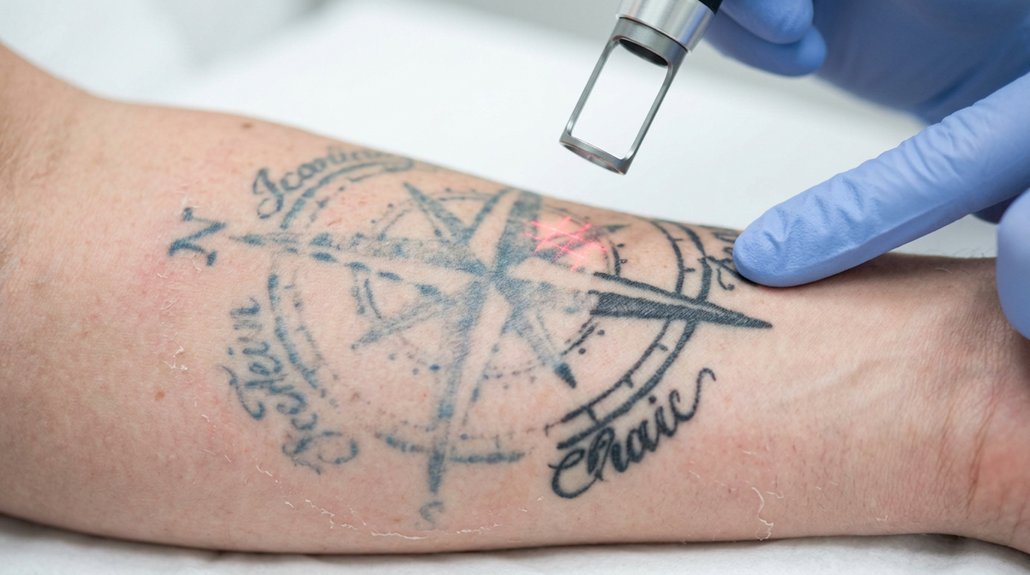 tattoo removal session count questions
